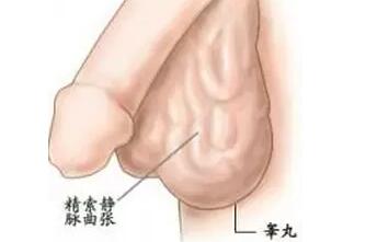 精索靜脈曲張，手術(shù)還是等待？