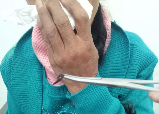 雞皮疙瘩掉一地，鼻子出螞蟥就在你身邊，你還敢喝生水嗎？