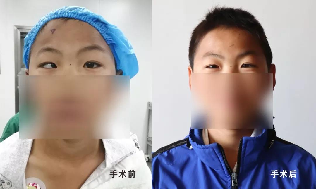 【保山安利醫(yī)院】?jī)和币暿中g(shù)再也不用跑省城了！