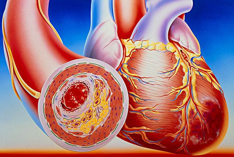 看清心臟動(dòng)脈，判斷病癥，及早治療冠心??！