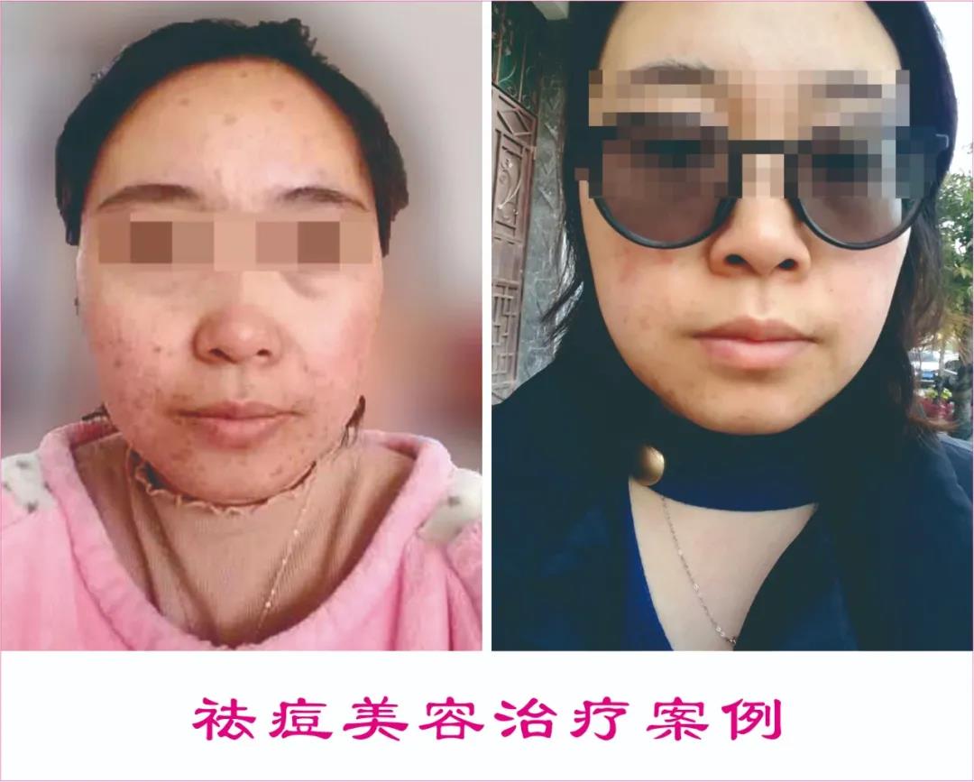 中醫(yī)駐顏，標(biāo)本兼治|中醫(yī)養(yǎng)生駐顏保健治療中心