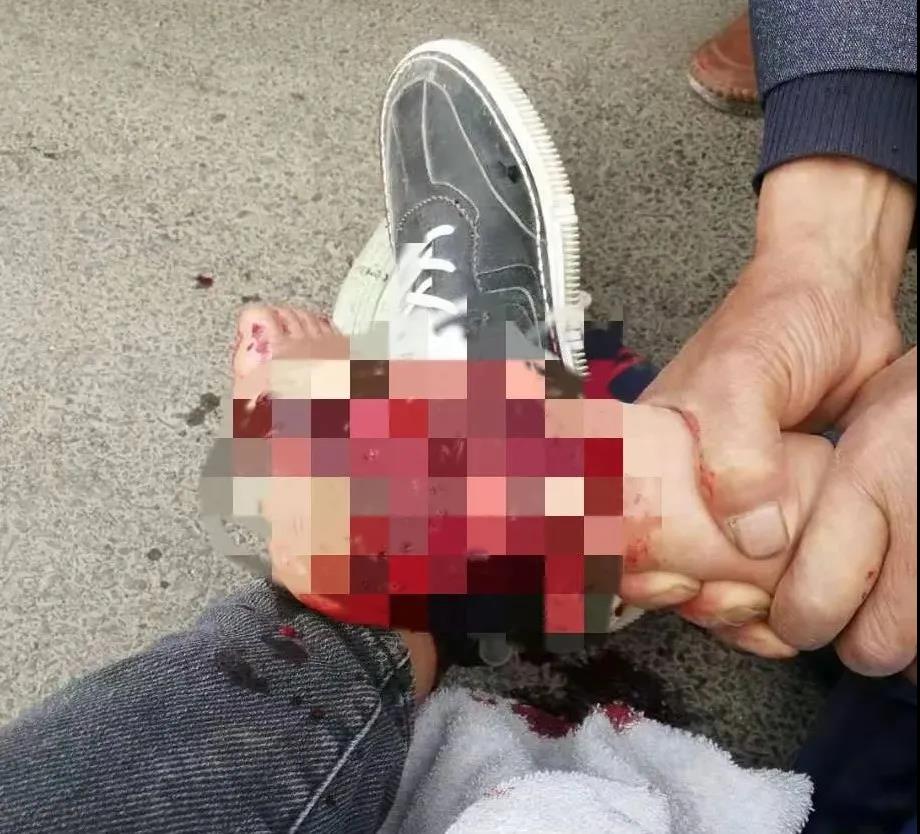 【保山安利醫(yī)院】創(chuàng)傷急救到處跑，不如安利把醫(yī)找！