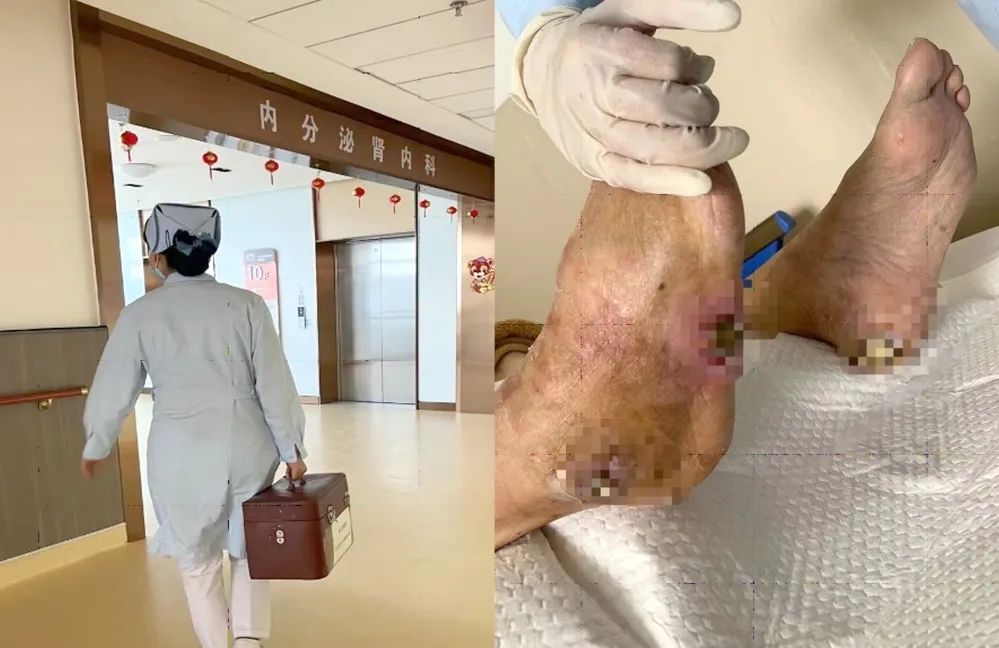 【保山安利醫(yī)院】傷口治療一站式，健康生活零距離！